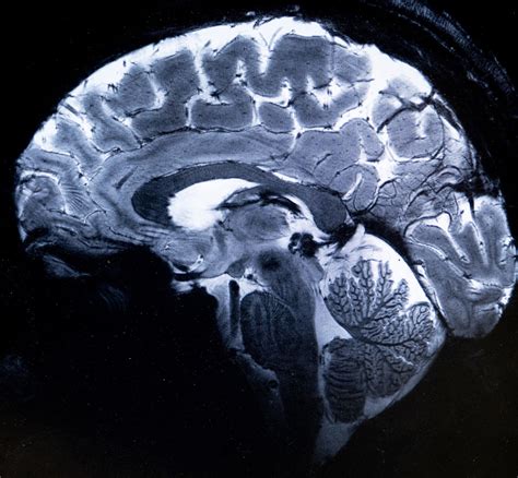the villages mri brain scan|World's most powerful MRI scans first images of .